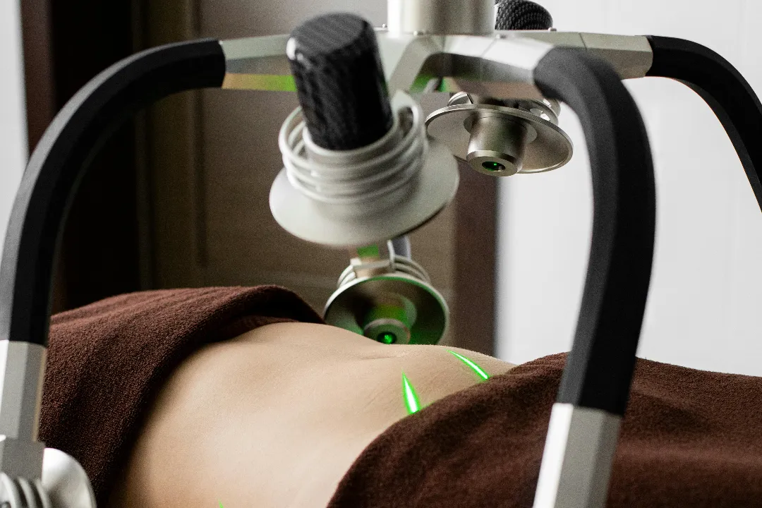 Non-Surgical Tummy Fat Removal Canberra