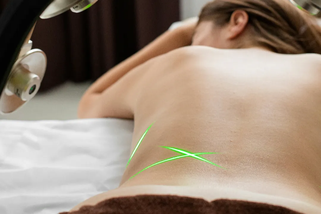 Non-Surgical Tummy Fat Removal Canberra