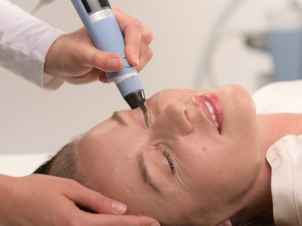 Exion RF microneedling handpiece during a face treatment